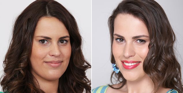 Adriana: Celulitída zmizla